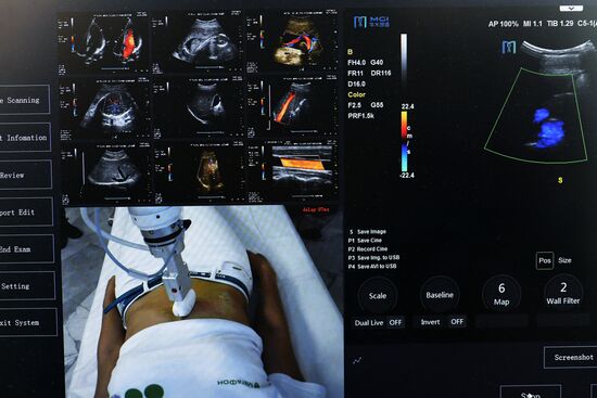 Telemedical equipment for remote ultrasound imaging at Morozov Children's Hospital