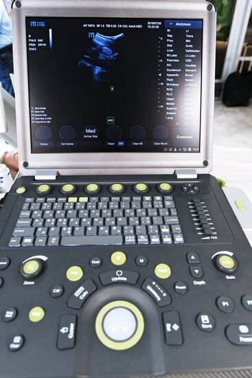 Telemedical equipment for remote ultrasound imaging at Morozov Children's Hospital