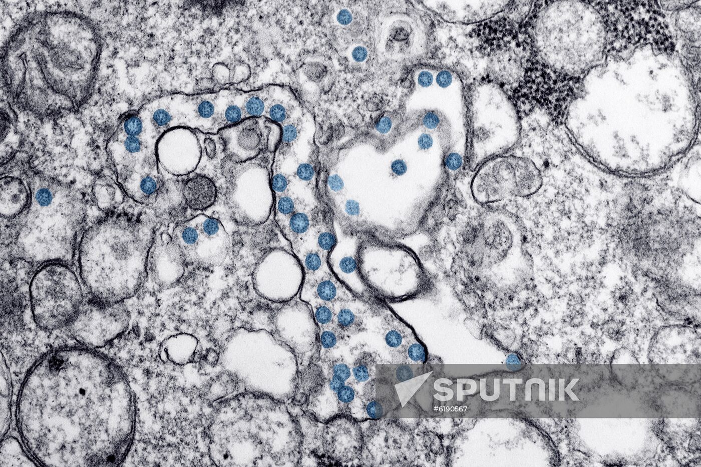 US New Coronavirus