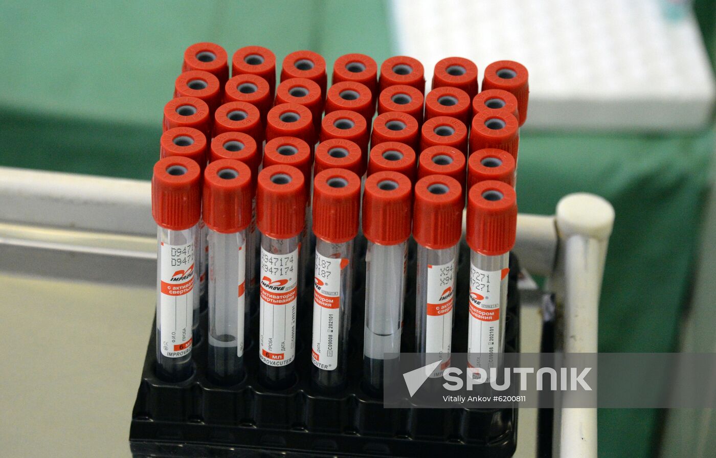 Russia Coronavirus Tests
