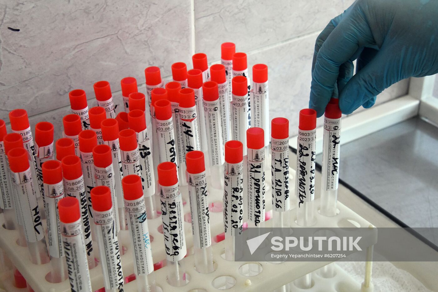 Russia Coronavirus Tests