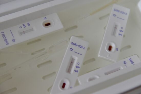Ukraine Coronavirus 