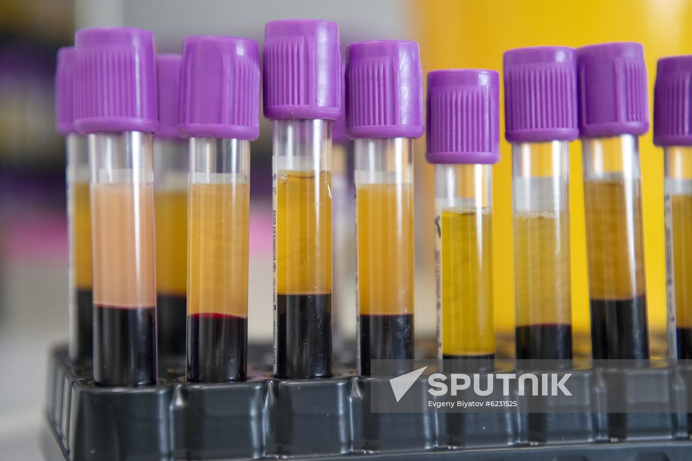 Russia Coronavirus Tests