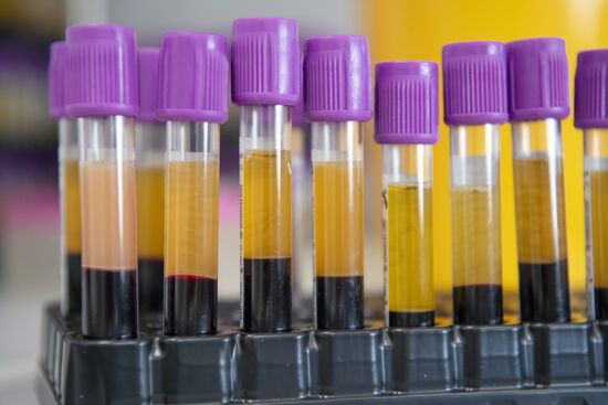 Russia Coronavirus Tests