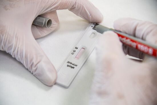 Russia Coronavirus Tests
