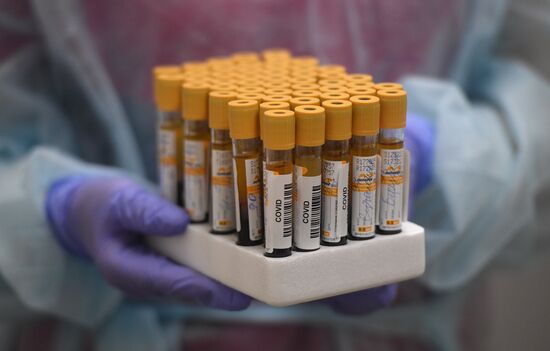 Russia Coronavirus Tests