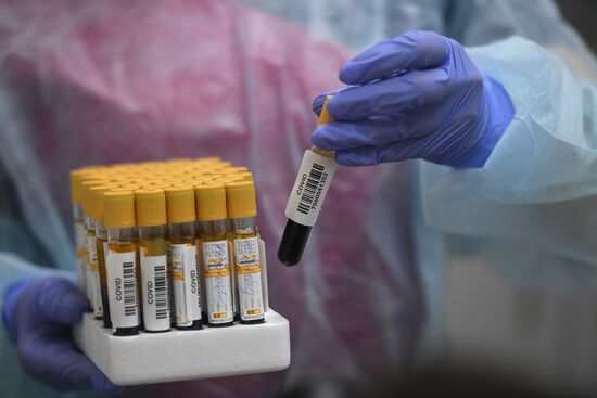 Russia Coronavirus Tests