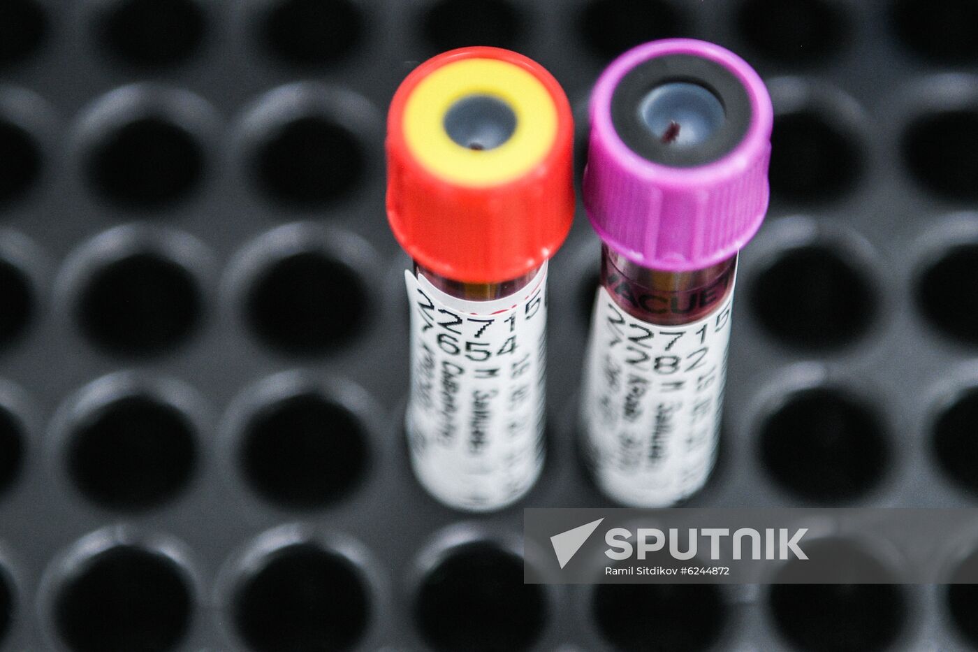 Russia Coronavirus Tests