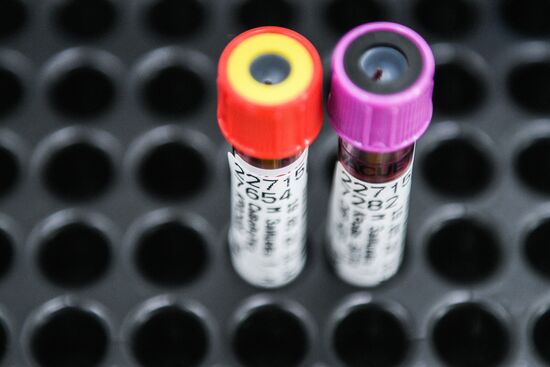 Russia Coronavirus Tests