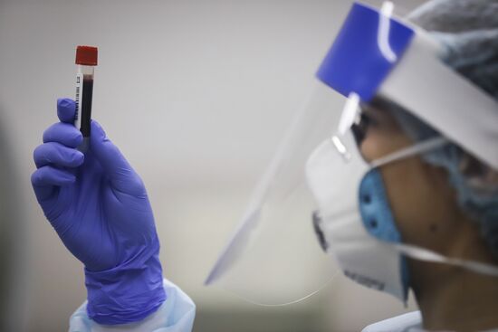 Russia Coronavirus Tests