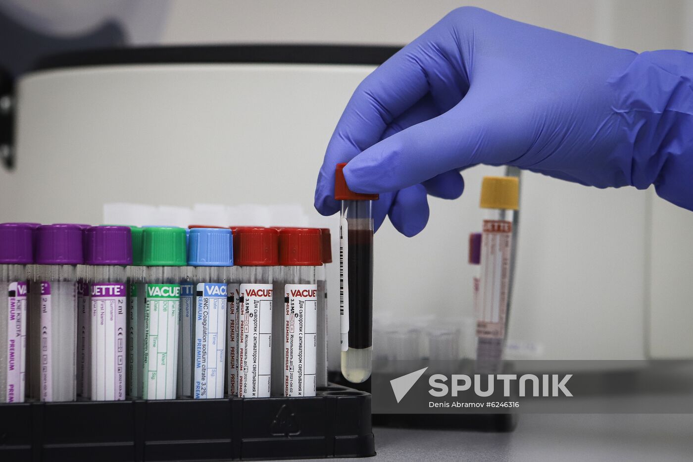 Russia Coronavirus Tests