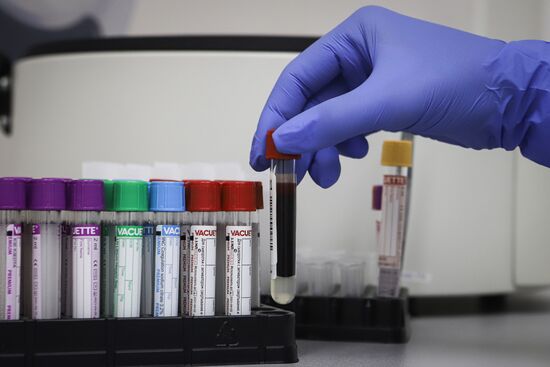 Russia Coronavirus Tests