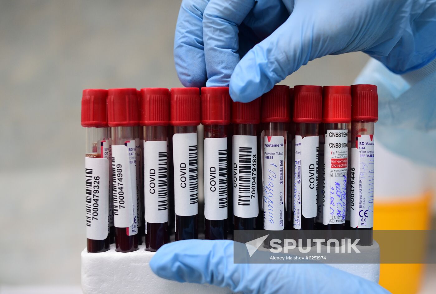 Russia Coronavirus Tests