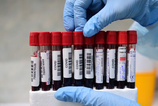 Russia Coronavirus Tests