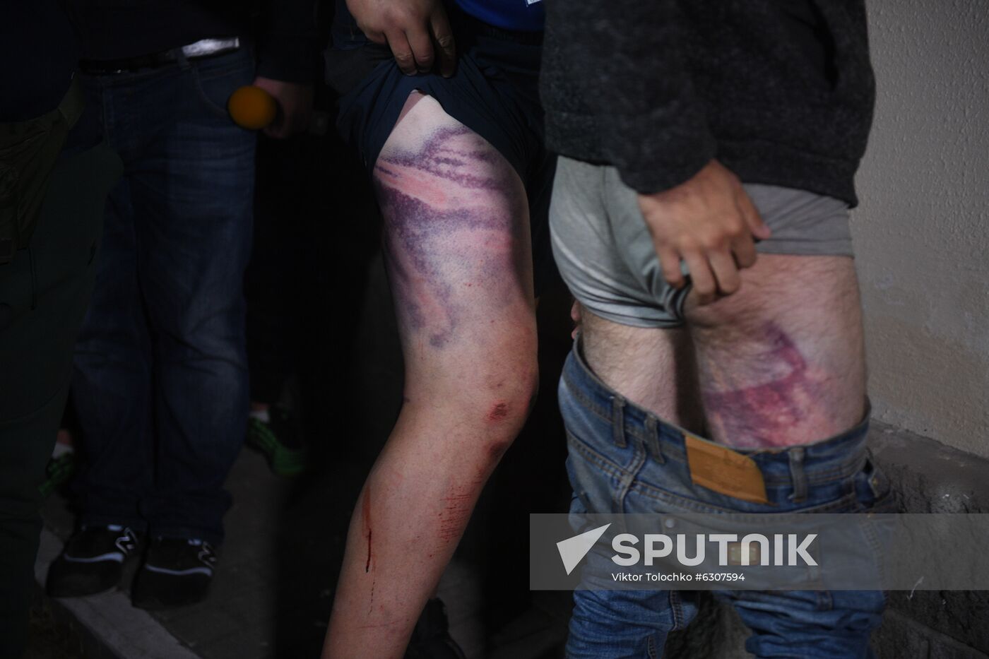 Belarus Presidential Election Protest Detained
