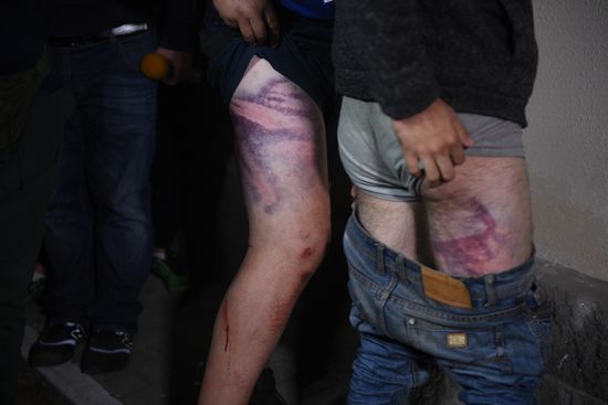 Belarus Presidential Election Protest Detained