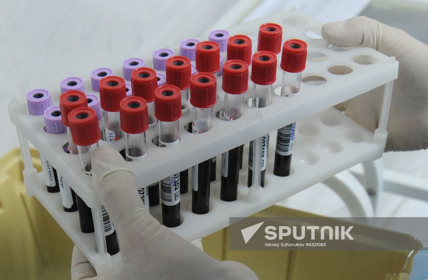 Russia Health Blood Transfusion