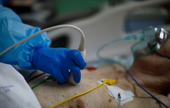 Russia Coronavirus Treatment