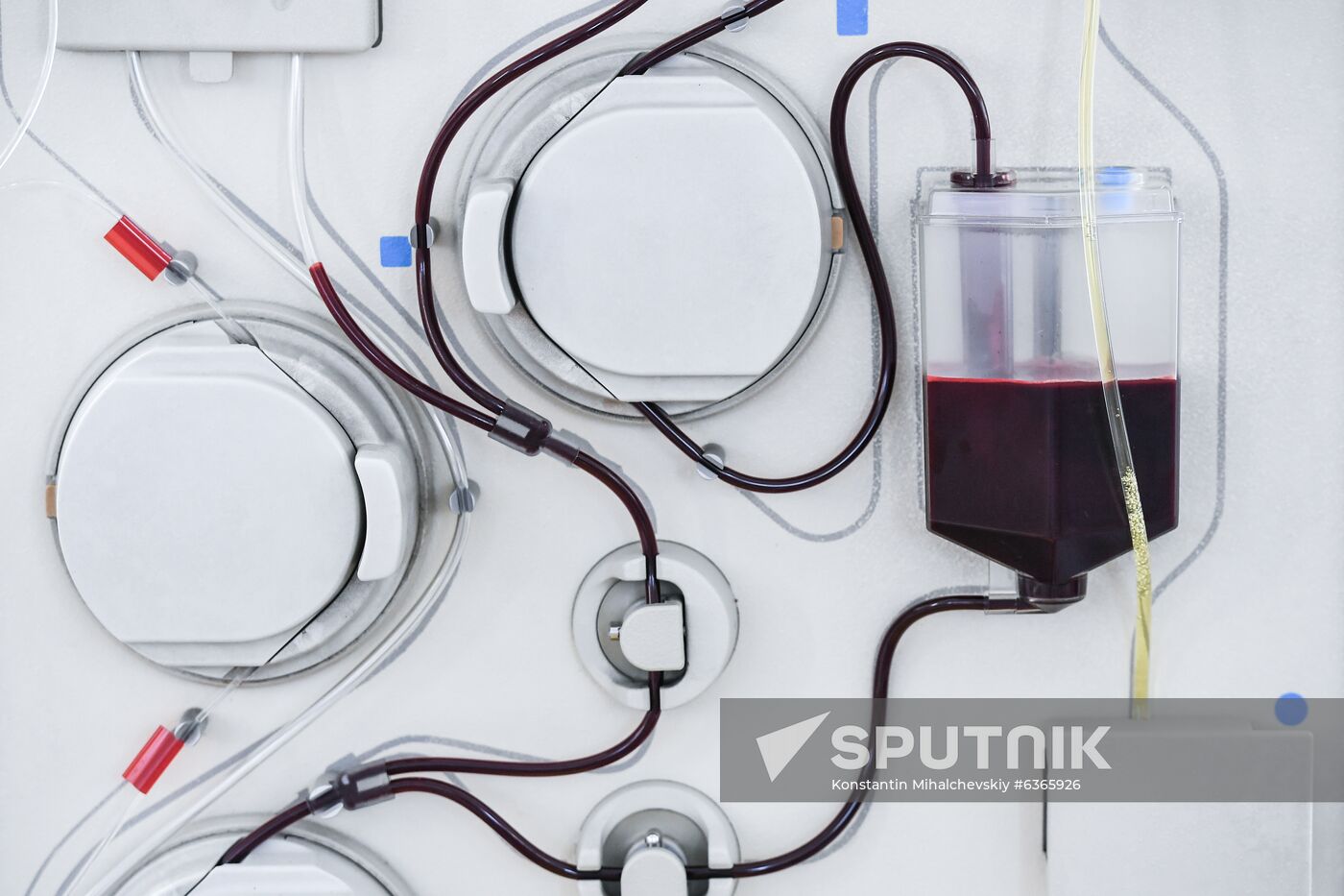 Russia Health Blood Transfusion