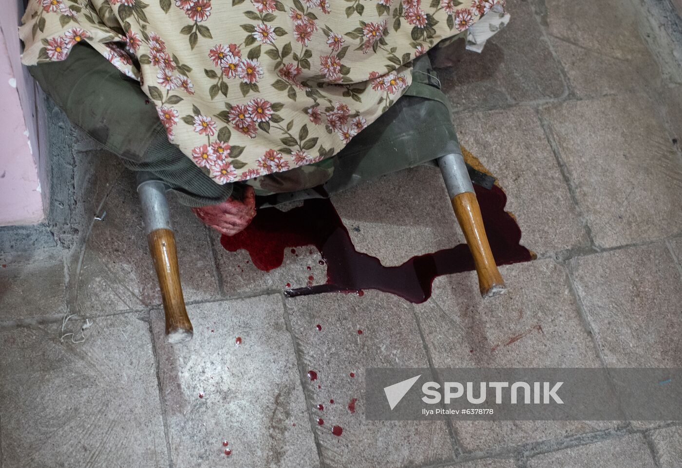 Azerbaijan Armenia Escalation