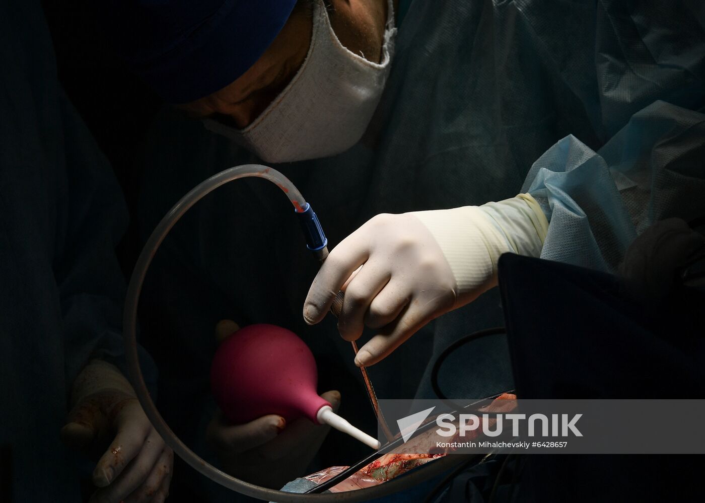 Russia Brain Tumors Surgery