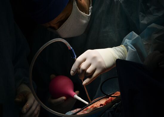 Russia Brain Tumors Surgery