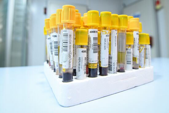 Azerbaijan Coronavirus Testing