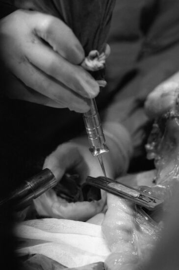 Universal laser scalpel