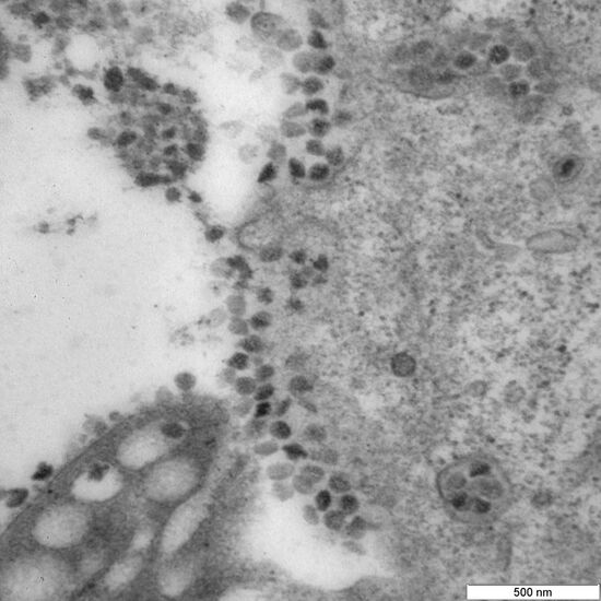 Russia Coronavirus Omicron Variant