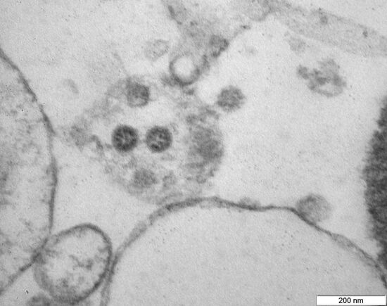 Russia Coronavirus Omicron Variant