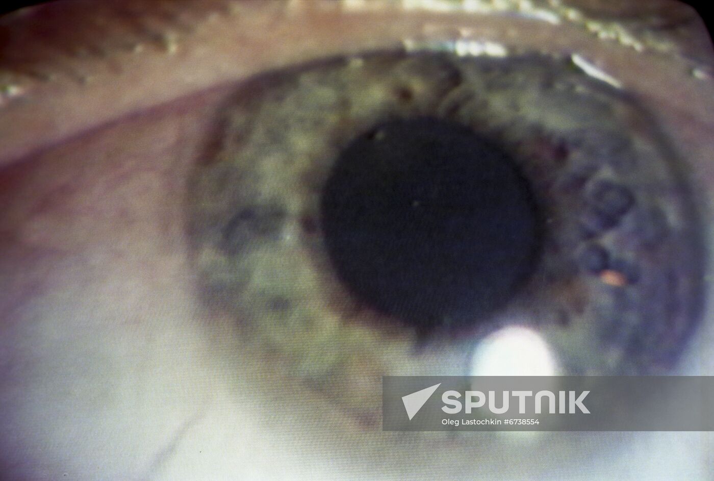 Iris-based diagnostics