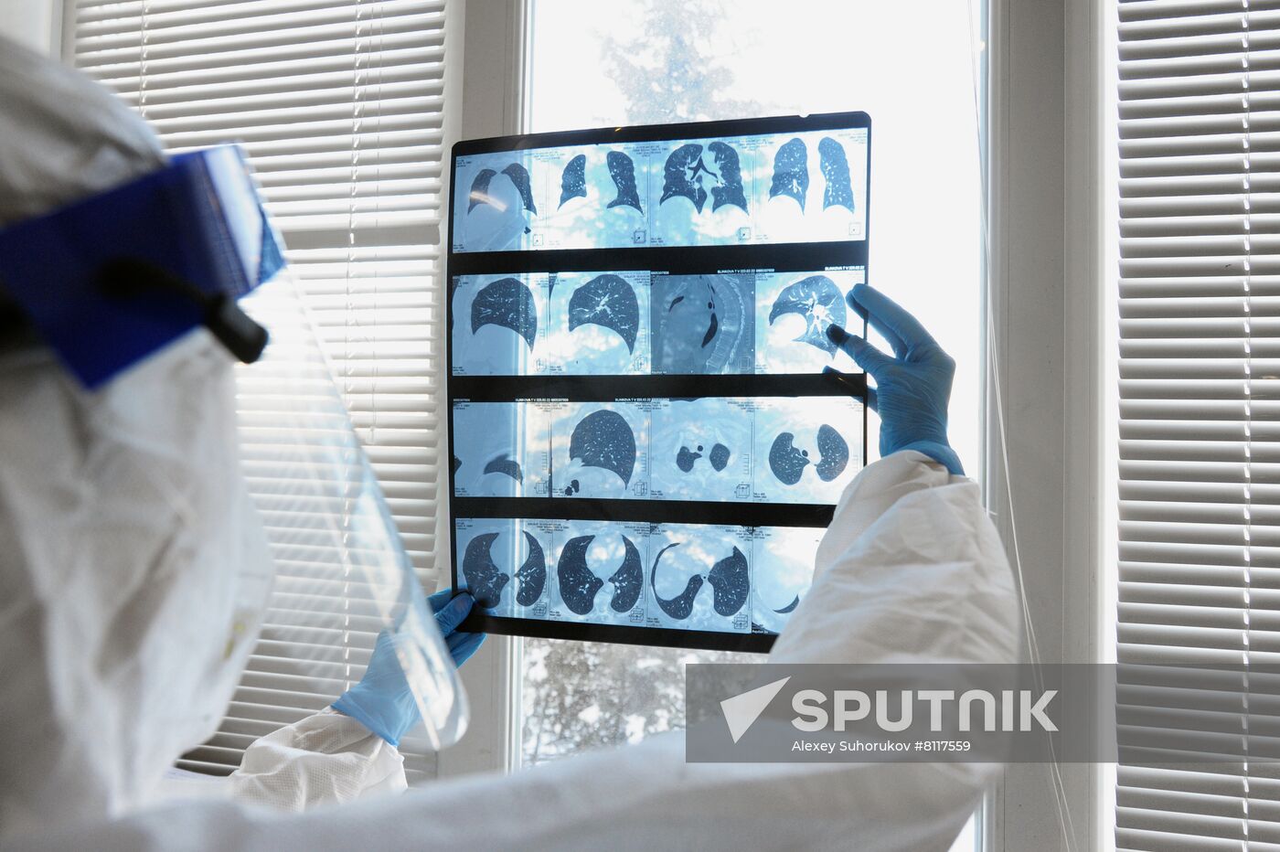 Russia Coronavirus Treatment