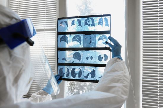 Russia Coronavirus Treatment