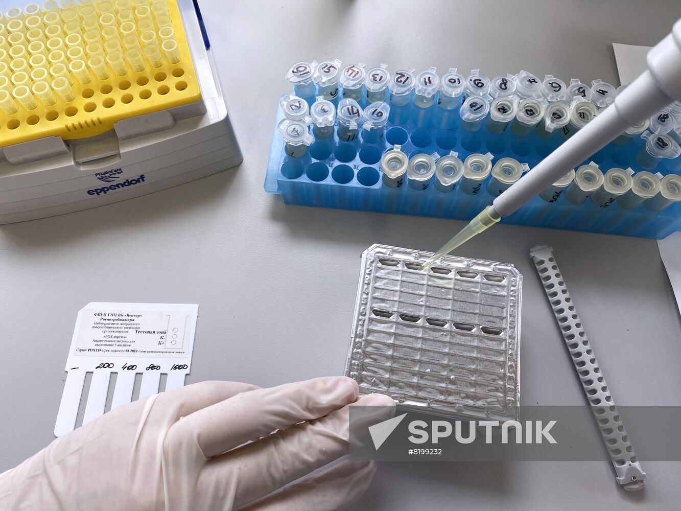 Russia Monkeypox Testing Kit