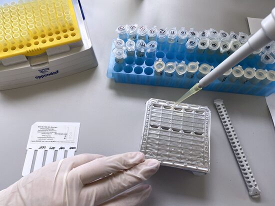 Russia Monkeypox Testing Kit