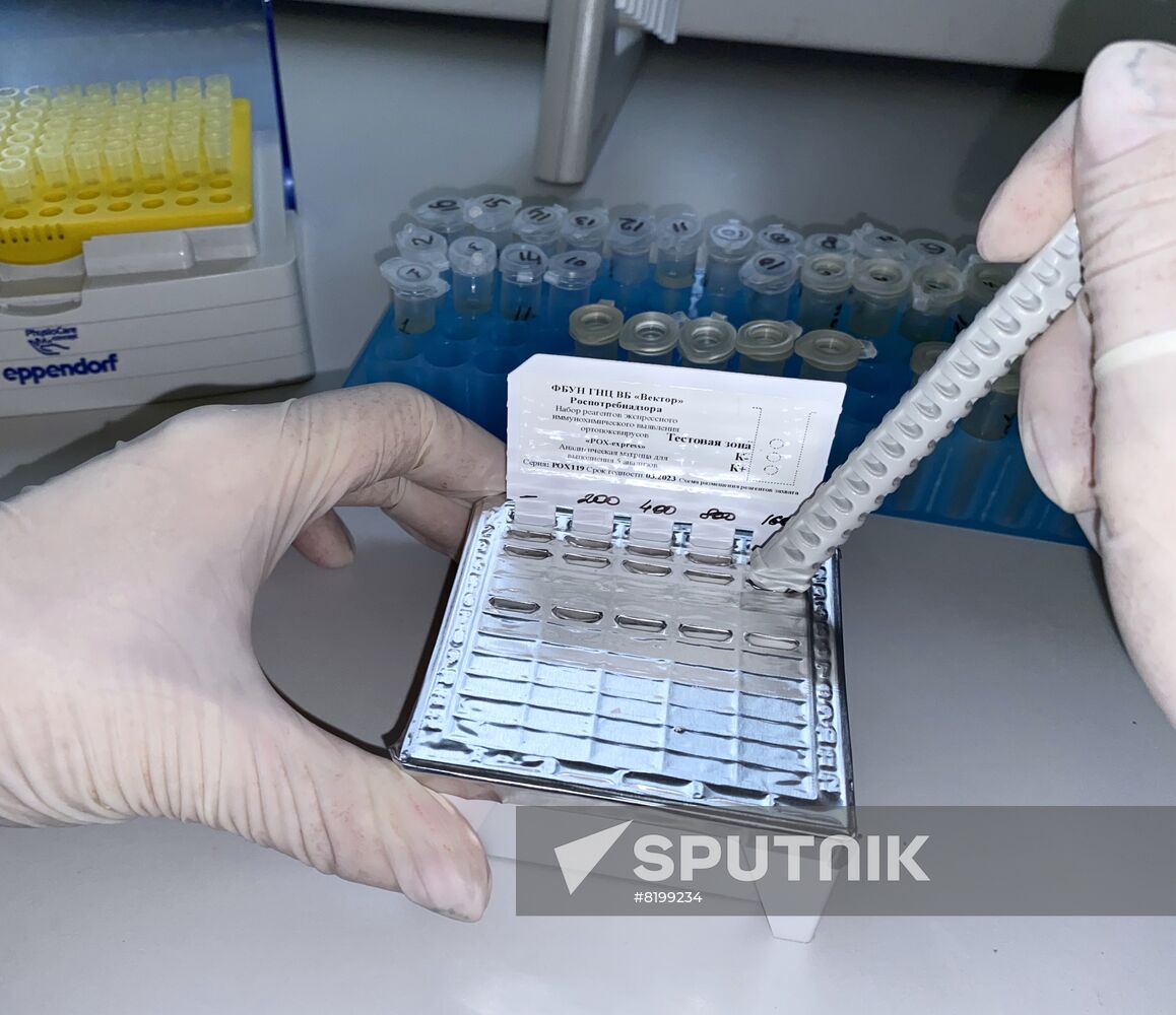 Russia Monkeypox Testing Kit