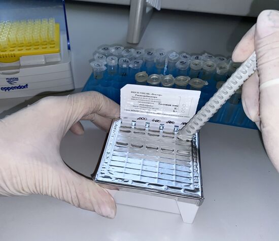Russia Monkeypox Testing Kit