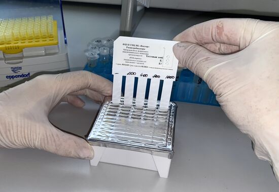 Russia Monkeypox Testing Kit