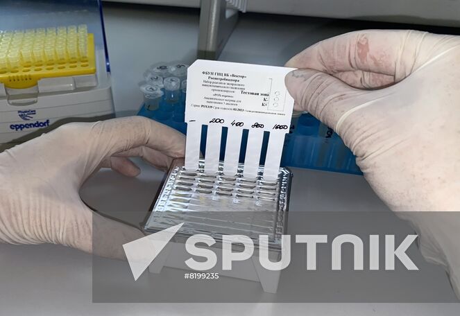 In this handout photo released by the Russian State Research Center of Virology and Biotechnology Vector, a test kit to detect monkeypox which was created at the center is on display in Novosibirsk, Russia. Editorial use only, no archive, no commercial use. Location: Russia, Novosibirsk. Russia Monkeypox Testing Kit
