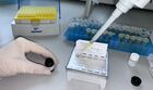 Russia Monkeypox Testing Kit