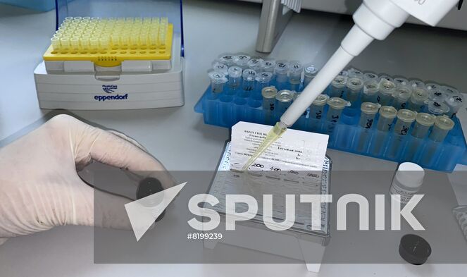 In this handout photo released by the Russian State Research Center of Virology and Biotechnology Vector, a test kit to detect monkeypox which was created at the center is on display in Novosibirsk, Russia. Editorial use only, no archive, no commercial use. Location: Russia, Novosibirsk. Russia Monkeypox Testing Kit