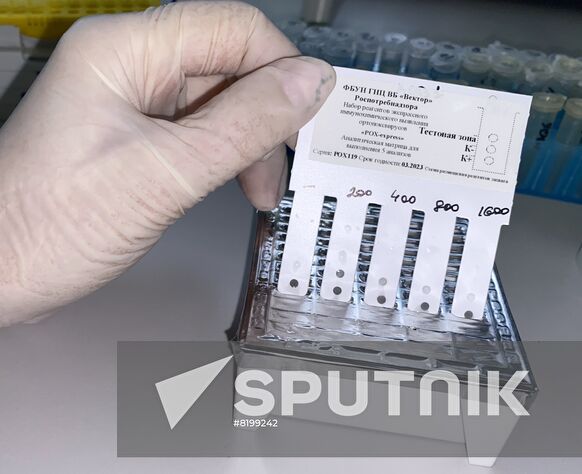 In this handout photo released by the Russian State Research Center of Virology and Biotechnology Vector, a test kit to detect monkeypox which was created at the center is on display in Novosibirsk, Russia. Editorial use only, no archive, no commercial use. Location: Russia, Novosibirsk. Russia Monkeypox Testing Kit