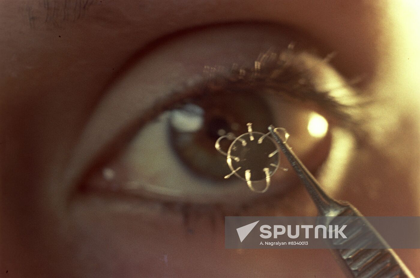 Artificial intraocular lens