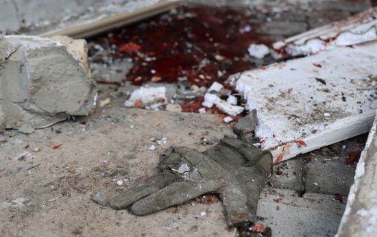 Russia Ukraine Military Operation Rogozin Wound