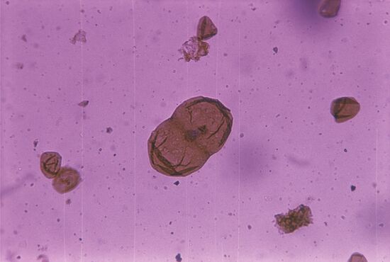 Unicellular organism