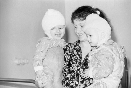 Siamese twins Vilija and Vitalija Tamuleviciute