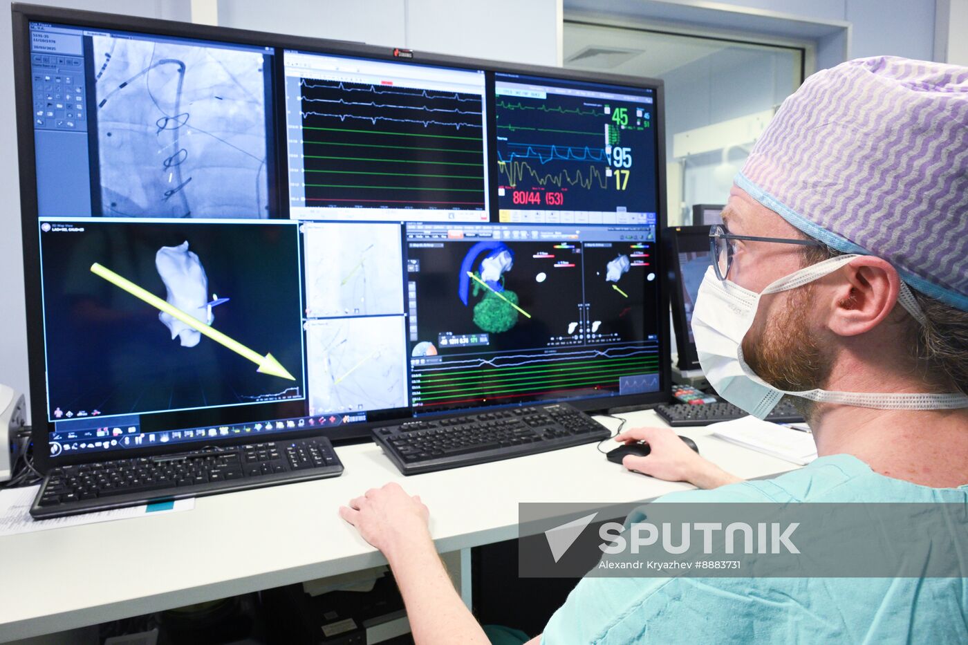 Russia Healthcare Cardiac Surgery
