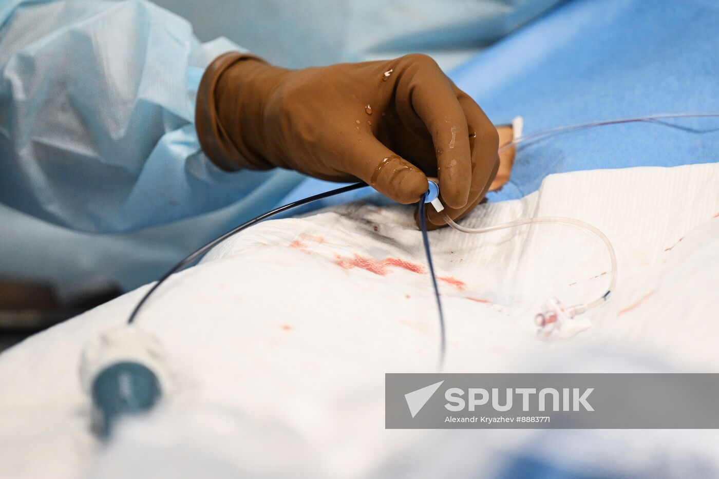 Russia Healthcare Cardiac Surgery
