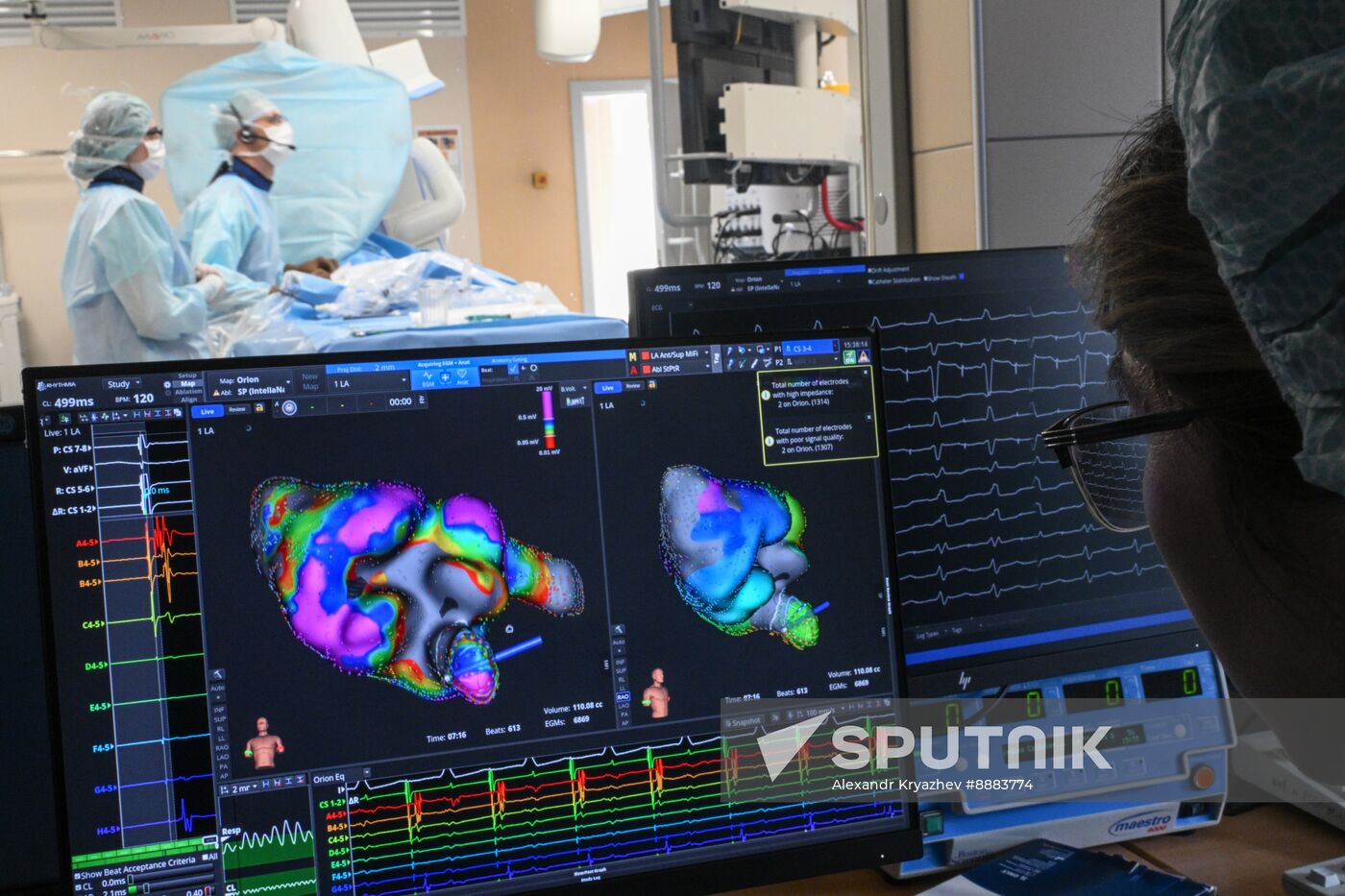 Russia Healthcare Cardiac Surgery