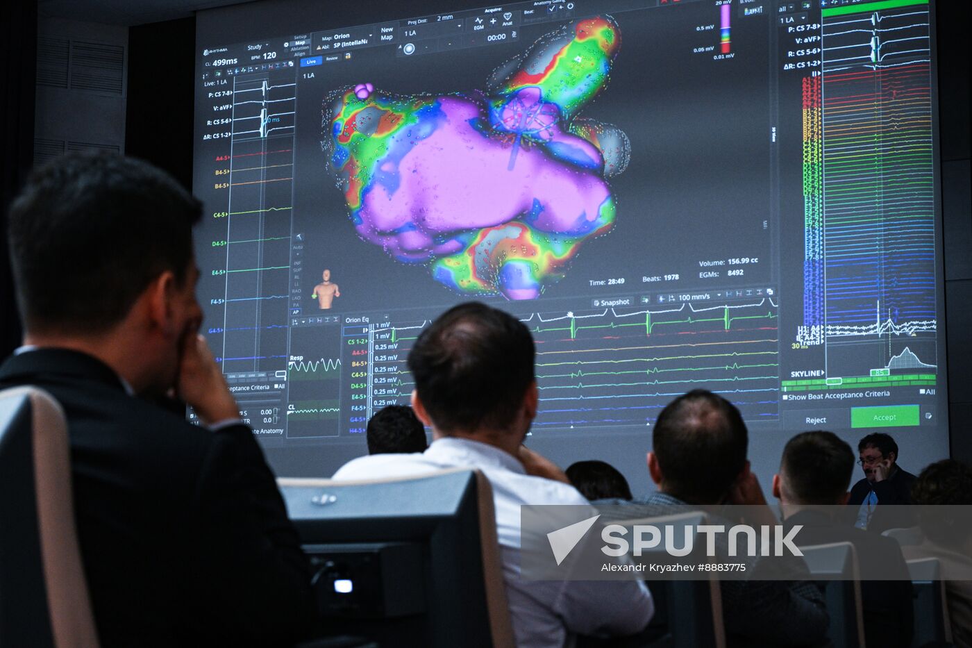 Russia Healthcare Cardiac Surgery